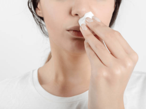 Nose bleeding treatment in Dubai