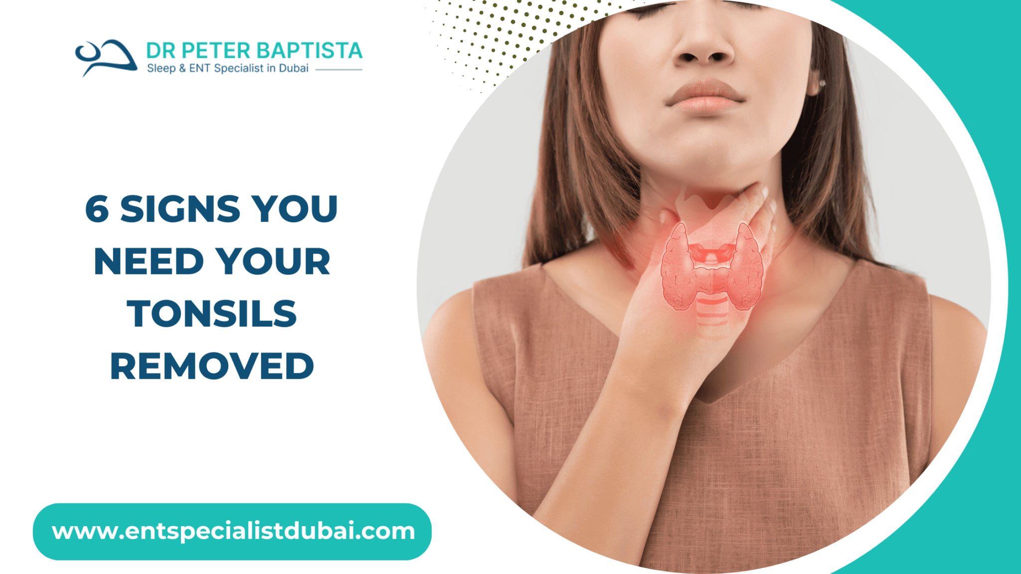 Signs You Need Tonsil Surgery Dr Peter Baptista ENT Specialist in Dubai