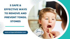 5 safe & effective ways to remove and prevent tonsil stones