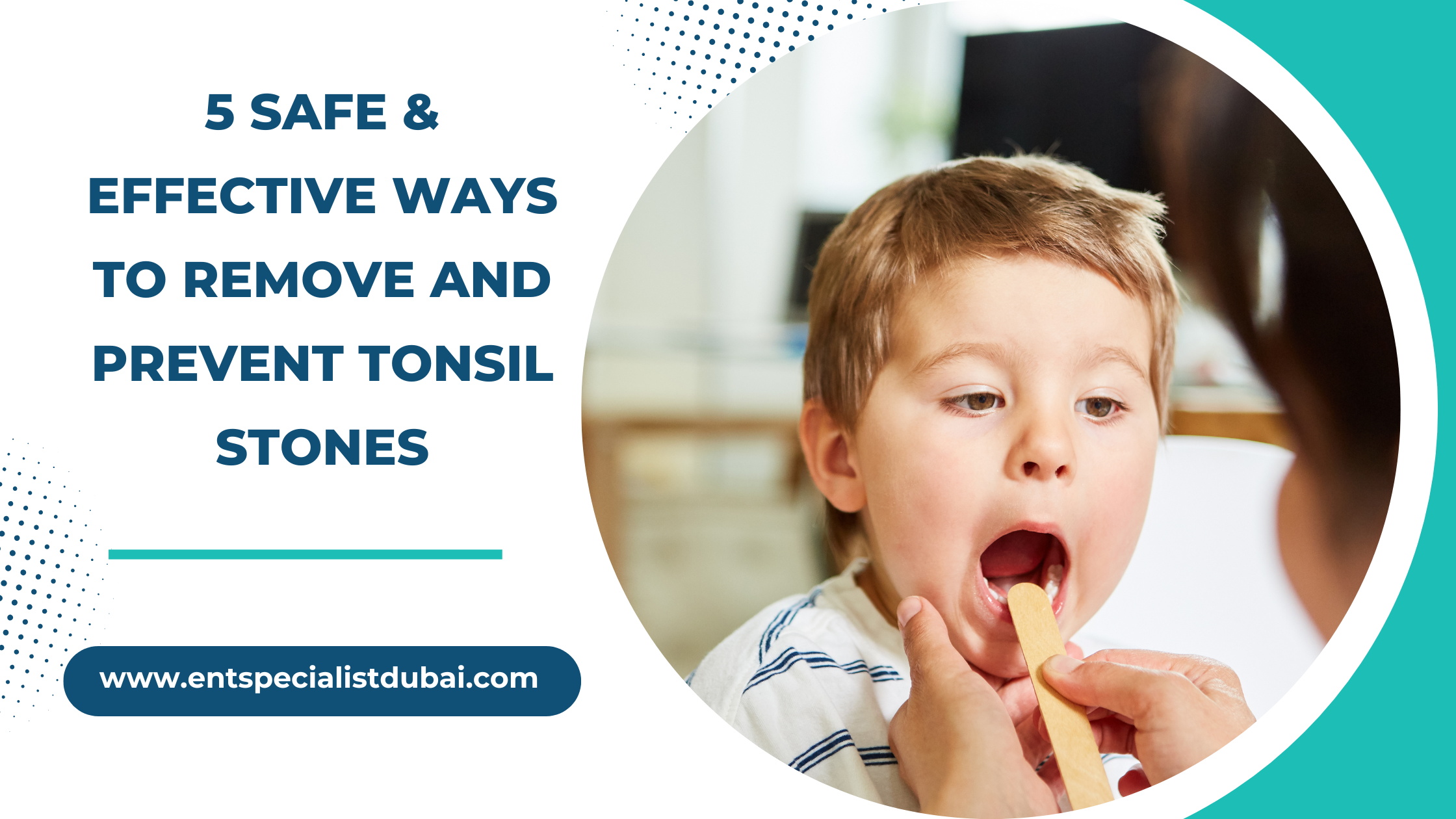 5 safe & effective ways to remove and prevent tonsil stones